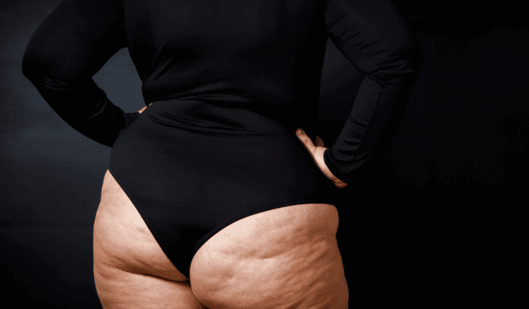 Le duo simple pour se débarrasser enfin de la culotte de cheval